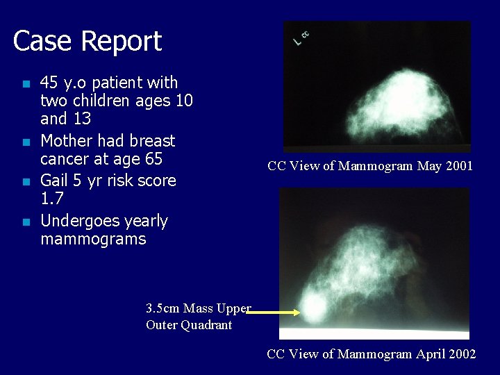 Case Report n n 45 y. o patient with two children ages 10 and