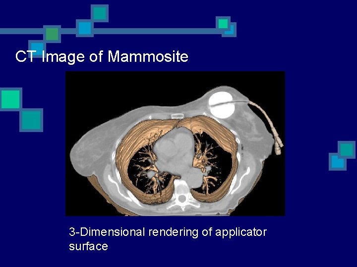 CT Image of Mammosite 3 -Dimensional rendering of applicator surface 