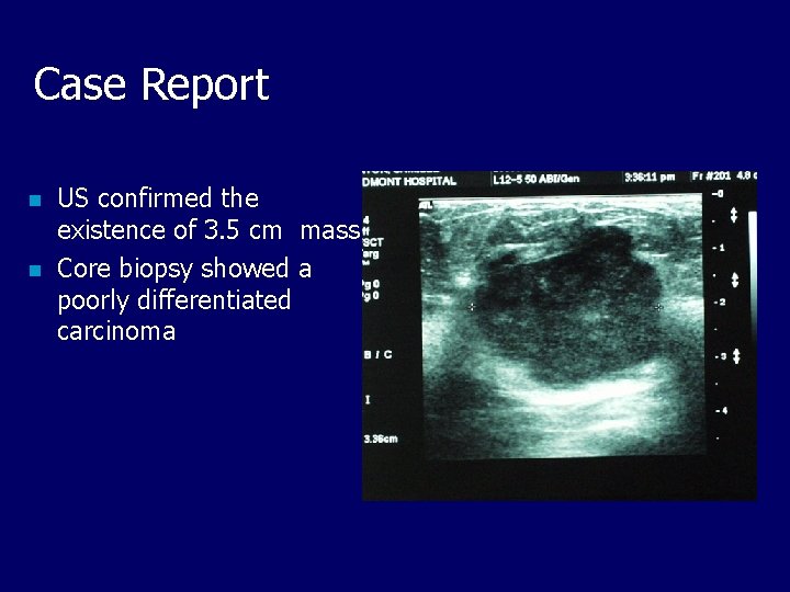 Case Report n n US confirmed the existence of 3. 5 cm mass Core