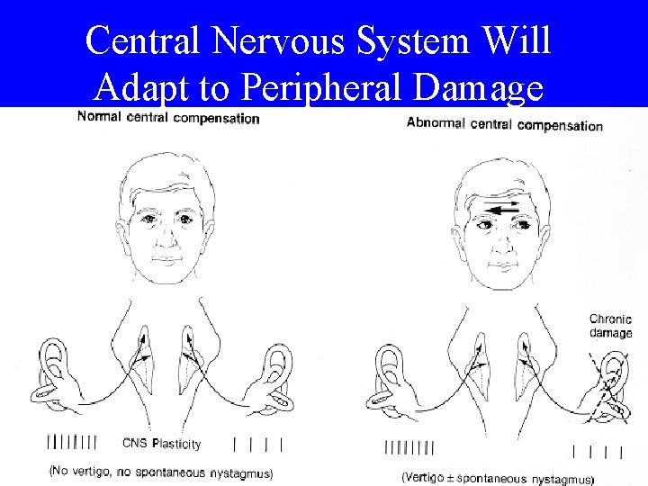 Central Nervous System Will Adapt to Peripheral Damage 