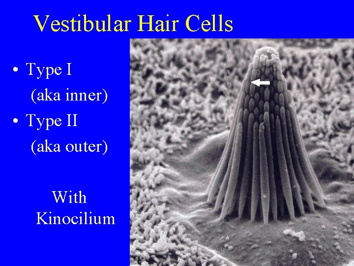 Vestibular Hair Cells • Type I (aka inner) • Type II (aka outer) With