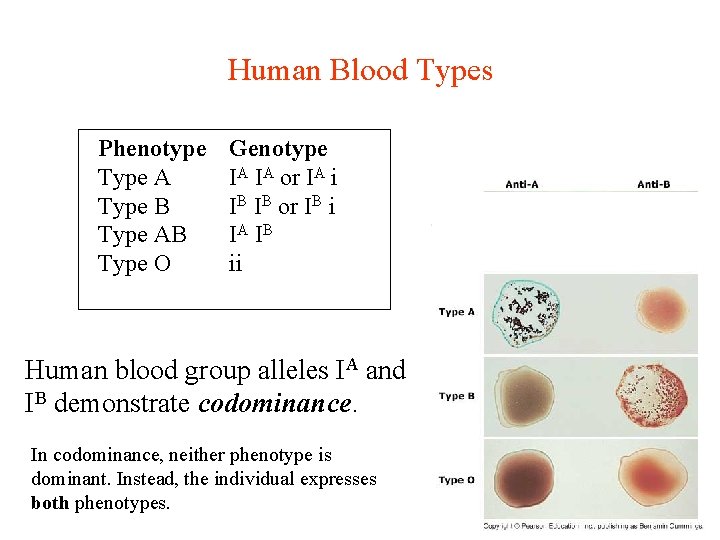 Human Blood Types Phenotype Type A Type B Type AB Type O Genotype IA