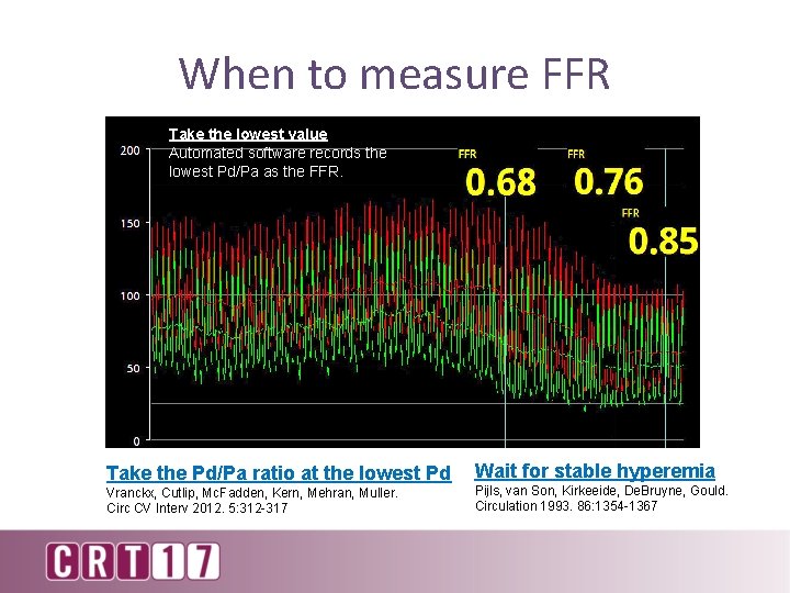 When to measure FFR Take the lowest value Automated software records the lowest Pd/Pa