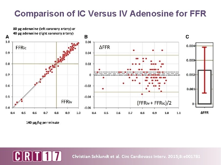 Comparison of IC Versus IV Adenosine for FFR 80 μg adenosine (left coronary artery)