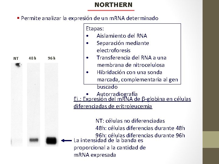 NORTHERN § Permite analizar la expresión de un m. RNA determinado NT 48 h