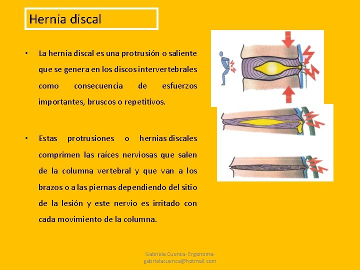 Hernia discal • La hernia discal es una protrusión o saliente que se genera