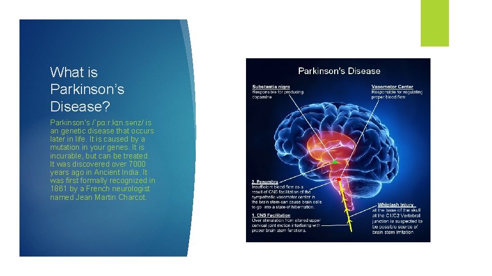 What is Parkinson’s Disease? Parkinson’s /ˈpɑːr. kɪn. sənz/ is an genetic disease that occurs
