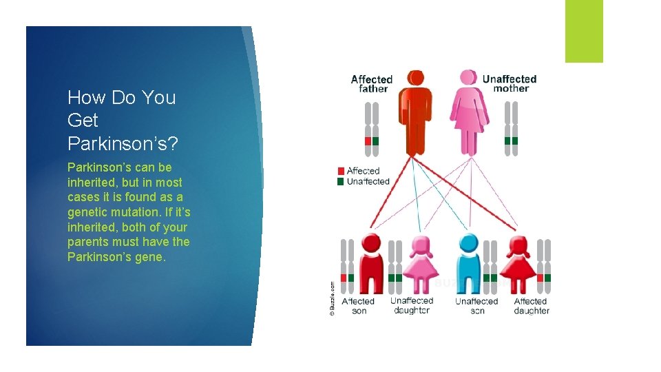 How Do You Get Parkinson’s? Parkinson’s can be inherited, but in most cases it