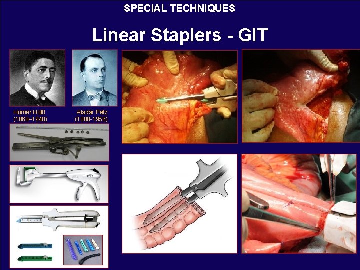 SPECIAL TECHNIQUES Linear Staplers - GIT Hümér Hültl (1868– 1940) Aladár Petz (1888 -1956)