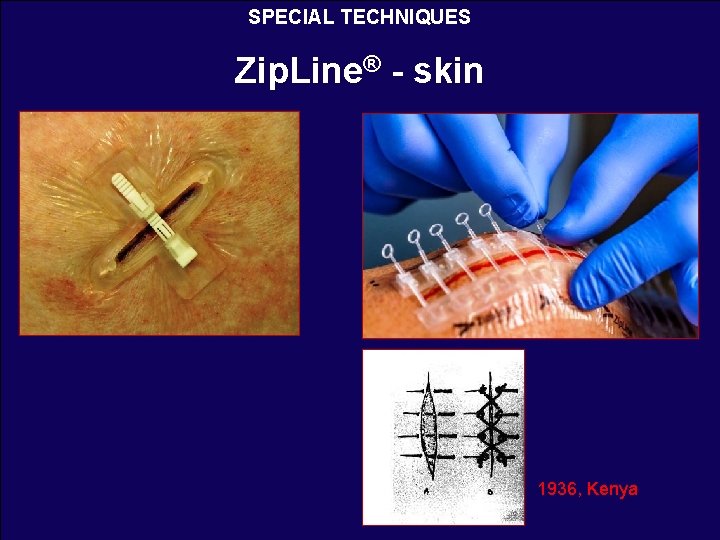 SPECIAL TECHNIQUES Zip. Line® - skin 1936, Kenya 