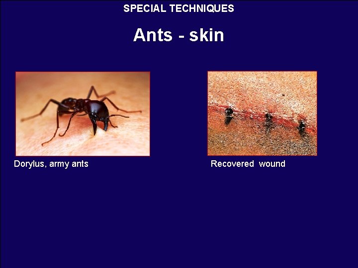 SPECIAL TECHNIQUES Ants - skin Dorylus, army ants Recovered wound 