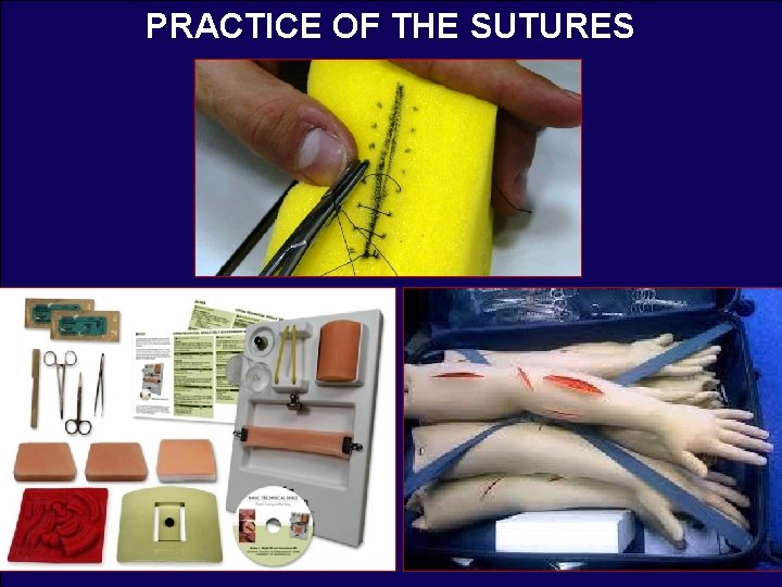 PRACTICE OF THE SUTURES 