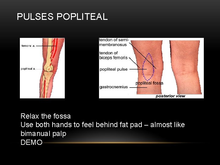 PULSES POPLITEAL Relax the fossa Use both hands to feel behind fat pad –