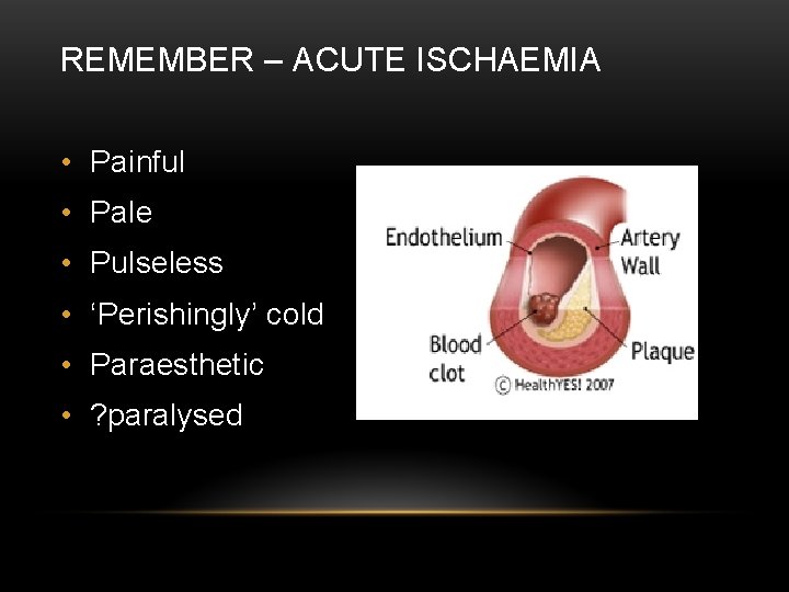 REMEMBER – ACUTE ISCHAEMIA • Painful • Pale • Pulseless • ‘Perishingly’ cold •