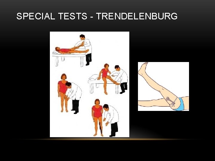 SPECIAL TESTS - TRENDELENBURG 