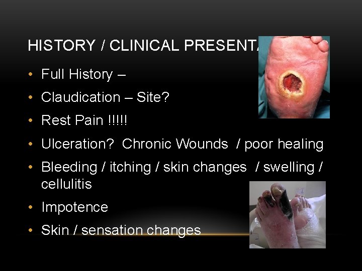 HISTORY / CLINICAL PRESENTATION • Full History – • Claudication – Site? • Rest