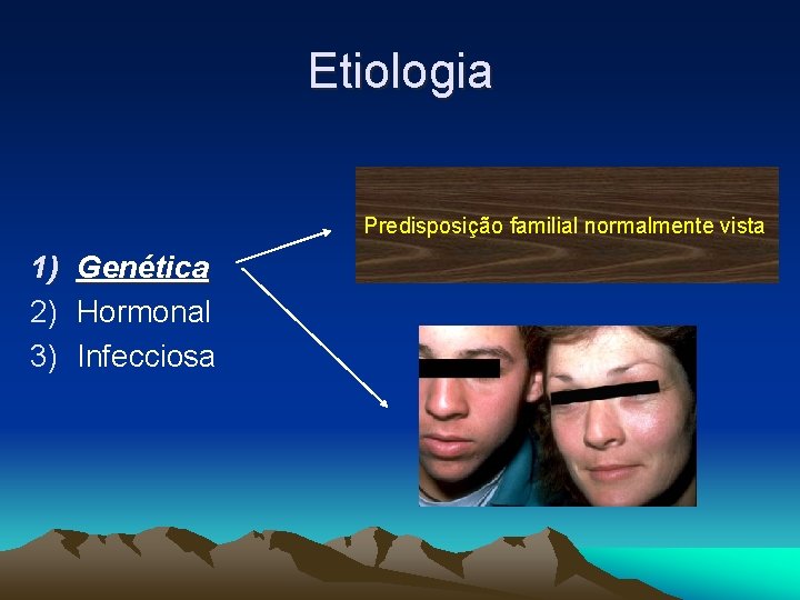 Etiologia Predisposição familial normalmente vista 1) Genética 2) Hormonal 3) Infecciosa 