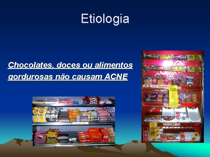 Etiologia Chocolates. doces ou alimentos gordurosas não causam ACNE 