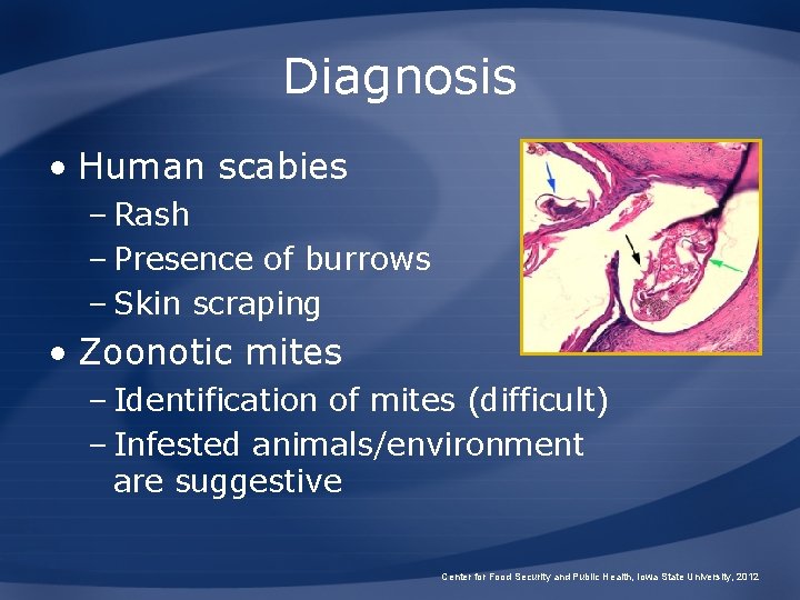 Diagnosis • Human scabies – Rash – Presence of burrows – Skin scraping •