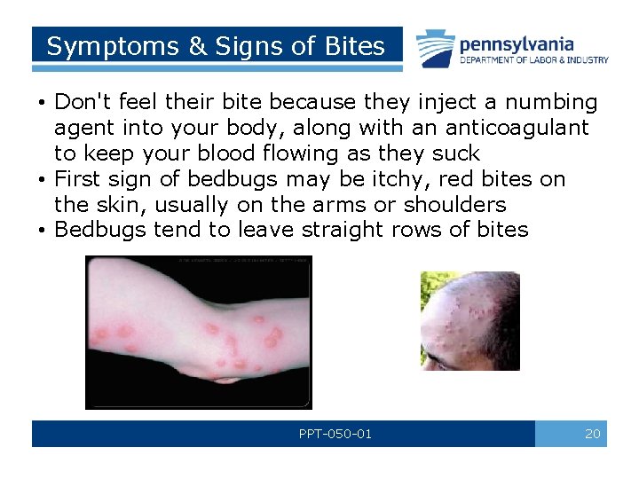 Symptoms & Signs of Bites • Don't feel their bite because they inject a