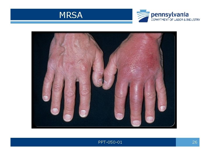 MRSA PPT-050 -01 26 