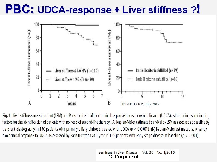 PBC: UDCA-response + Liver stiffness ? ! C. Corpechot 