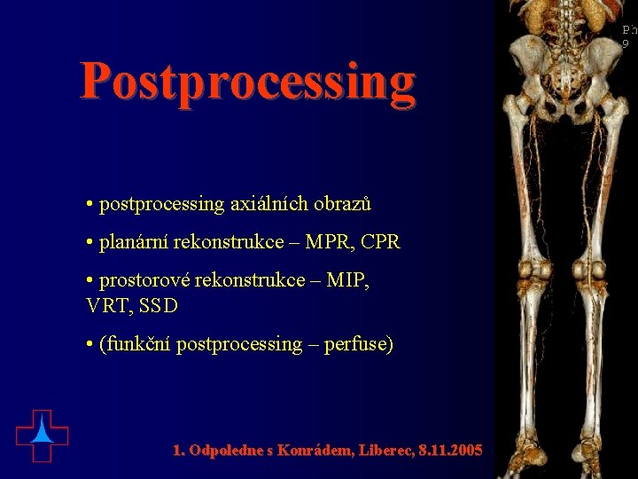 Postprocessing • postprocessing axiálních obrazů • planární rekonstrukce – MPR, CPR • prostorové rekonstrukce