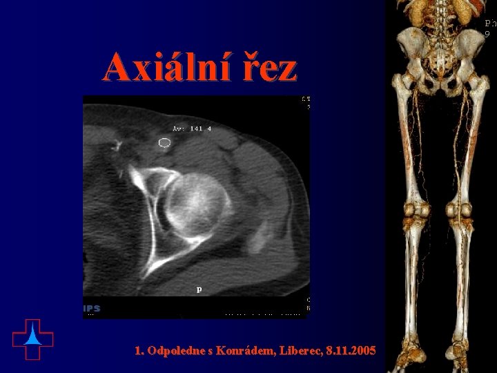 Axiální řez 1. Odpoledne s Konrádem, Liberec, 8. 11. 2005 