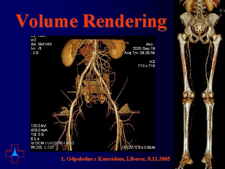 Volume Rendering 1. Odpoledne s Konrádem, Liberec, 8. 11. 2005 