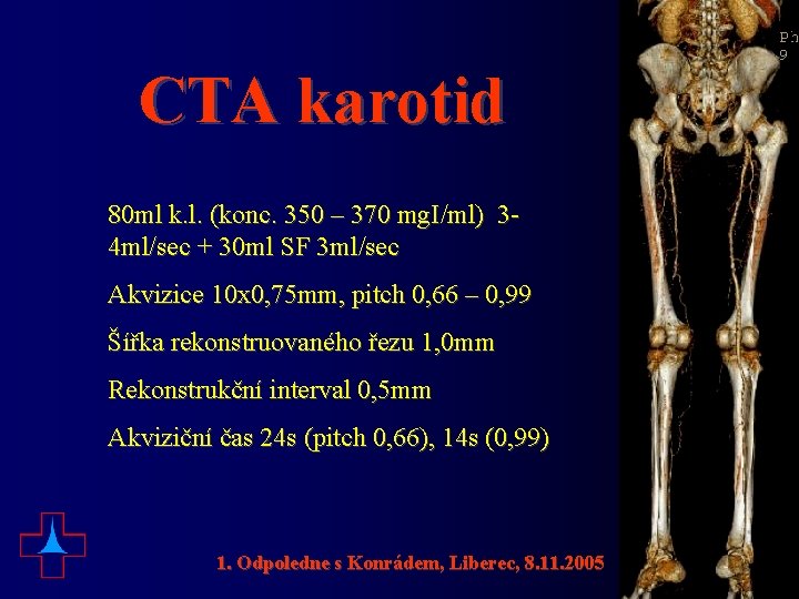 CTA karotid 80 ml k. l. (konc. 350 – 370 mg. I/ml) 34 ml/sec