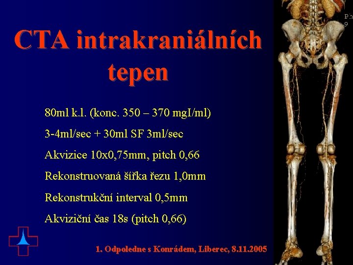 CTA intrakraniálních tepen 80 ml k. l. (konc. 350 – 370 mg. I/ml) 3