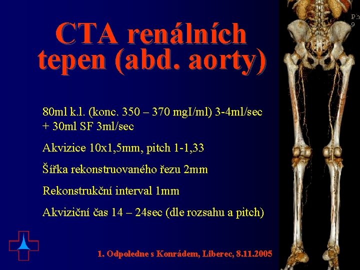 CTA renálních tepen (abd. aorty) 80 ml k. l. (konc. 350 – 370 mg.