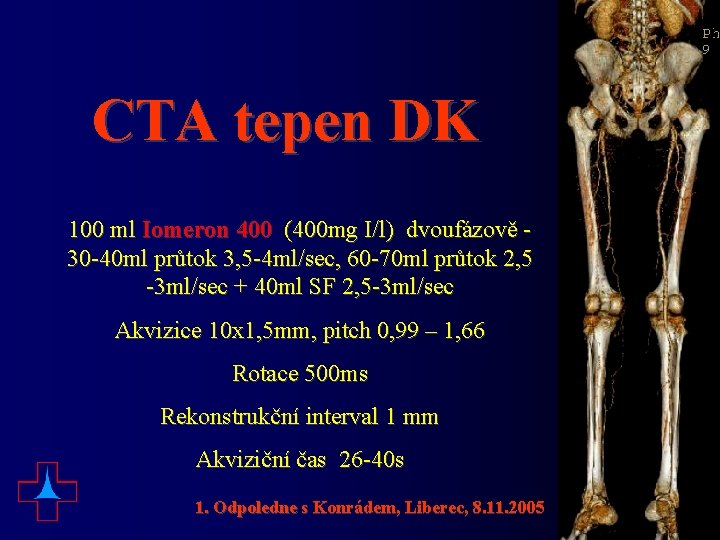 CTA tepen DK 100 ml Iomeron 400 (400 mg I/l) dvoufázově 30 -40 ml