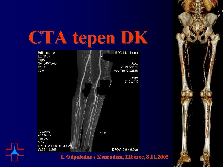 CTA tepen DK 1. Odpoledne s Konrádem, Liberec, 8. 11. 2005 