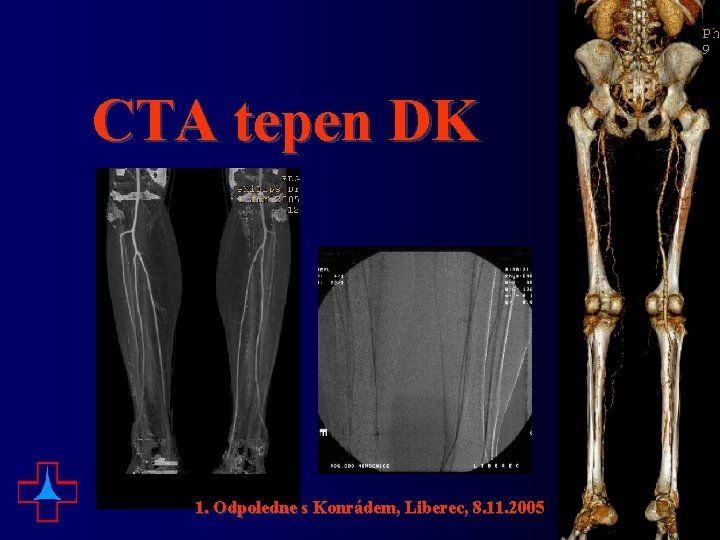 CTA tepen DK 1. Odpoledne s Konrádem, Liberec, 8. 11. 2005 