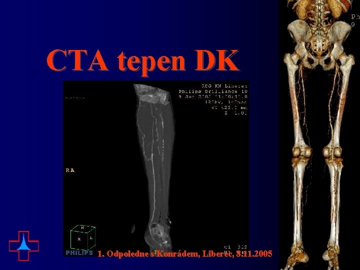 CTA tepen DK 1. Odpoledne s Konrádem, Liberec, 8. 11. 2005 