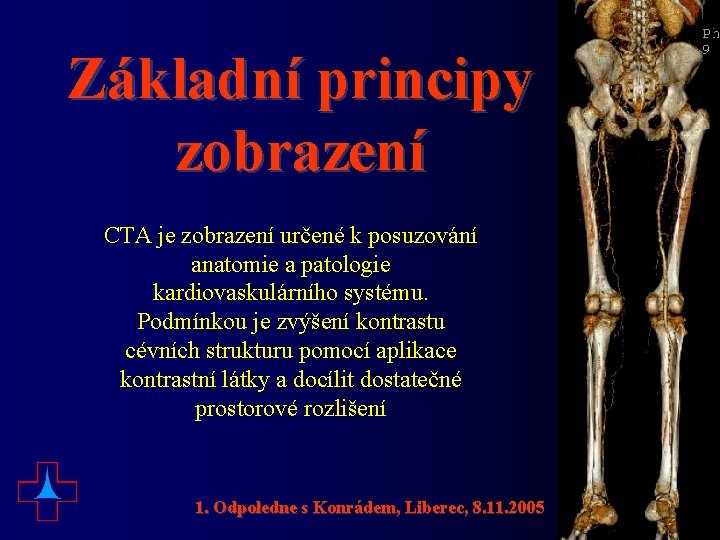 Základní principy zobrazení CTA je zobrazení určené k posuzování anatomie a patologie kardiovaskulárního systému.