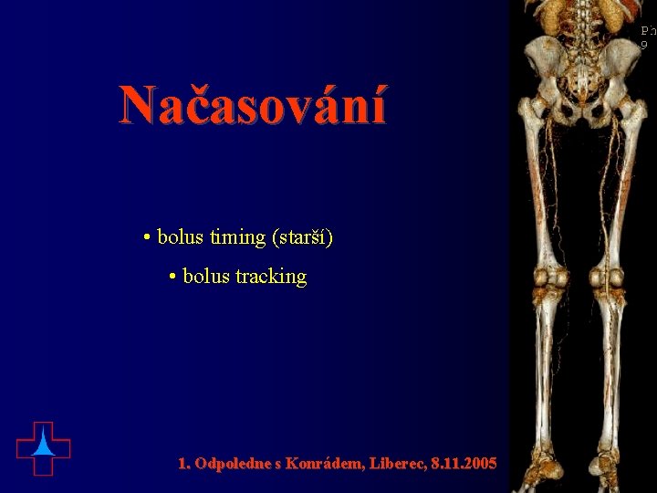 Načasování • bolus timing (starší) • bolus tracking 1. Odpoledne s Konrádem, Liberec, 8.