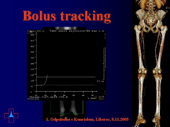 Bolus tracking 1. Odpoledne s Konrádem, Liberec, 8. 11. 2005 