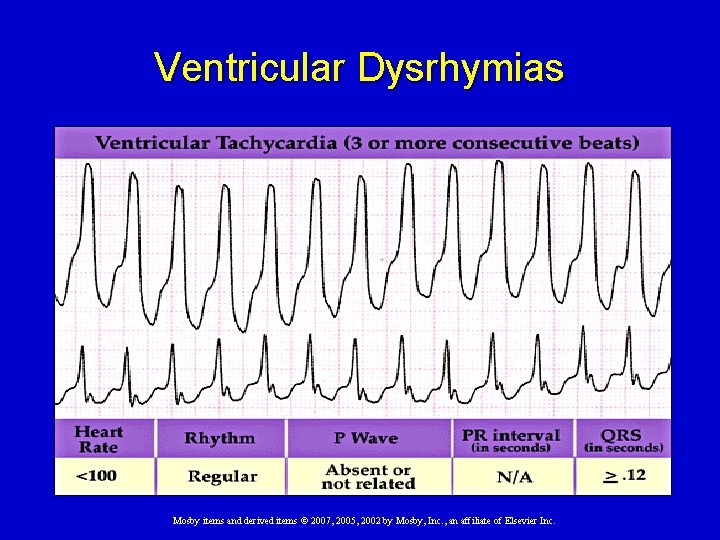 Ventricular Dysrhymias Mosby items and derived items © 2007, 2005, 2002 by Mosby, Inc.