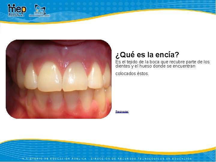 ¿Qué es la encía? Es el tejido de la boca que recubre parte de