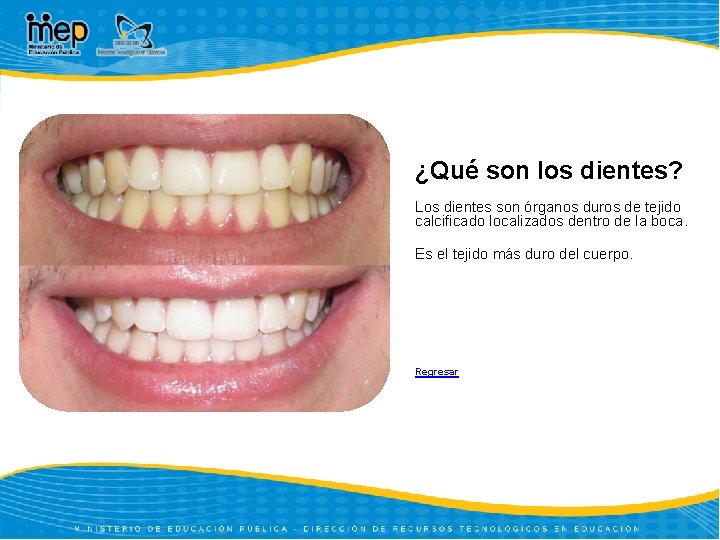 ¿Qué son los dientes? Los dientes son órganos duros de tejido calcificado localizados dentro