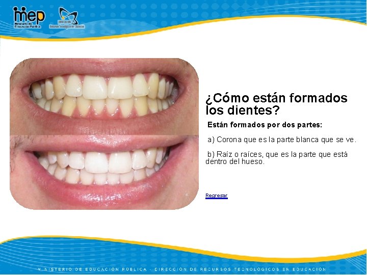 ¿Cómo están formados los dientes? Están formados por dos partes: a) Corona que es