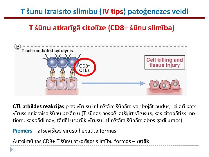 T šūnu izraisīto slimību (IV tips) patoģenēzes veidi T šūnu atkarīgā citolīze (CD 8+