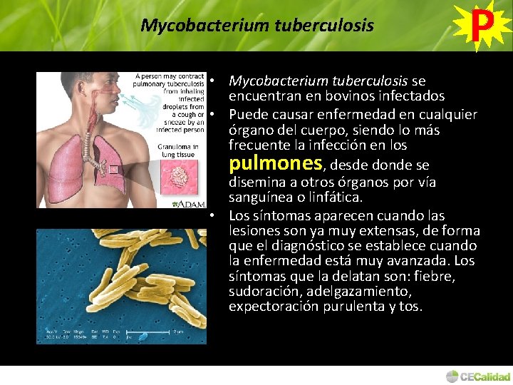 Mycobacterium tuberculosis P • Mycobacterium tuberculosis se encuentran en bovinos infectados • Puede causar