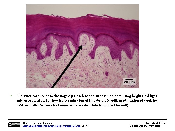  • Meissner corpuscles in the fingertips, such as the one viewed here using