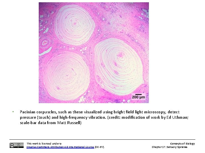  • Pacinian corpuscles, such as these visualized using bright field light microscopy, detect