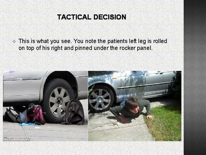 TACTICAL DECISION v This is what you see. You note the patients left leg