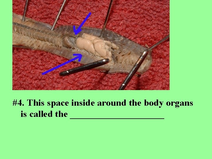 #4. This space inside around the body organs is called the __________ 