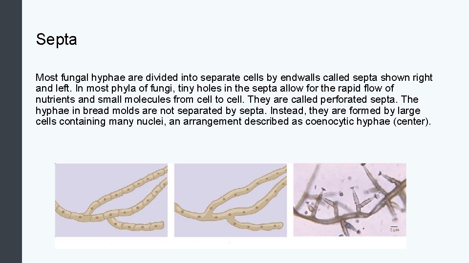 Septa Most fungal hyphae are divided into separate cells by endwalls called septa shown
